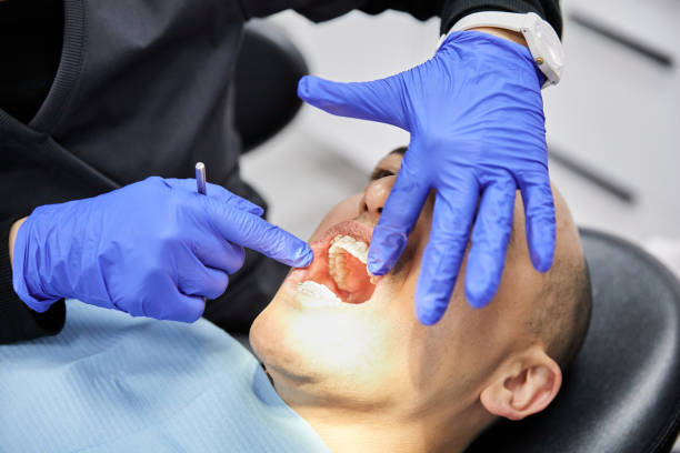 Best Emergency Dental Care for Sports Injuries in Mattydale, NY